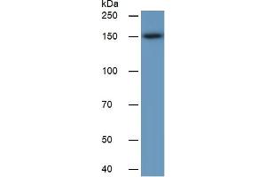 Western Blotting (WB) image for Carcinoembryonic Antigen Gene Family (CEA) ELISA Kit (ABIN6730922)