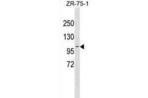 Western Blotting (WB) image for anti-Programmed Cell Death 6 Interacting Protein (PDCD6IP) antibody (ABIN3001245) (ALIX 抗体)