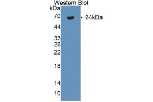 Western blot analysis of the recombinant protein. (Bestrophin 1 抗体  (AA 292-585))