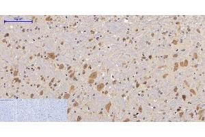 Immunohistochemistry of paraffin-embedded Mouse brain tissue with Phospho-FAK (Tyr397) Polyclonal Antibody at dilution of 1:200 (FAK 抗体  (pTyr397))