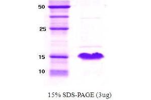 Figure annotation denotes ug of protein loaded and % gel used. (alpha Synuclein 61140 (active) 蛋白)