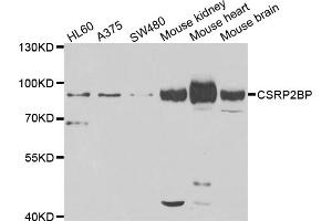 Western blot analysis of extracts of various cell lines, using CSRP2BP antibody (ABIN5975516) at 1/1000 dilution. (CSRP2BP 抗体)