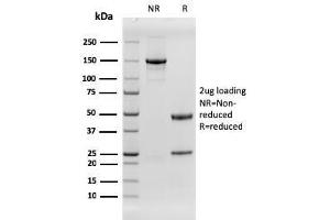 SDS-PAGE Analysis Purified EGFR Recombinant Mouse Monoclonal Antibody (rGFR/1667). (Recombinant EGFR 抗体)