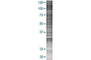 BRWD1 transfected lysate. (BRWD1 293T Cell Transient Overexpression Lysate(Denatured))