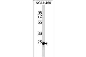 Western blot analysis in NCI-H460 cell line lysates (35ug/lane). (Galectin 3 抗体  (C-Term))