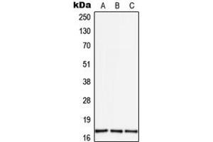 Western blot analysis of TGF alpha expression in THP1 (A), mouse brain (B), rat brain (C) whole cell lysates. (TGFA 抗体  (Center))