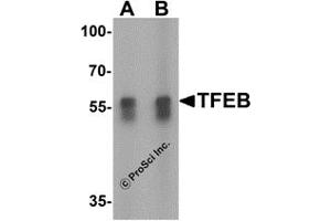 Western Blotting (WB) image for anti-Transcription Factor EB (TFEB) (N-Term) antibody (ABIN1031613) (TFEB 抗体  (N-Term))