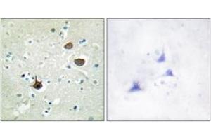 Immunohistochemistry analysis of paraffin-embedded human brain, using CXCR4 (Phospho-Ser339) Antibody. (CXCR4 抗体  (pSer339))