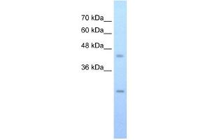 WB Suggested Anti-FLJ20489 Antibody Titration:  0. (FLJ20489 (C-Term) 抗体)