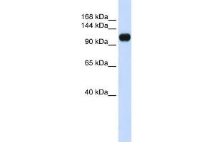 Human 293T; WB Suggested Anti-KIAA0692 Antibody Titration: 0. (ANKLE2 抗体  (Middle Region))