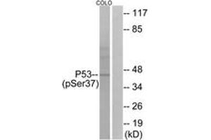 Western Blotting (WB) image for anti-Tumor Protein P53 (TP53) (pSer37) antibody (ABIN2888500) (p53 抗体  (pSer37))