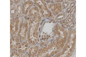 ABIN6267294 at 1/200 staining human kidney sections by IHC-P. (HSP27 抗体  (pSer15))