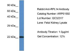 Western Blotting (WB) image for anti-Ribosomal Protein L14 (RPL14) (C-Term) antibody (ABIN786470) (RPL14 抗体  (C-Term))