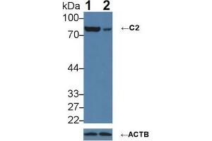 Knockout Varification: Lane 1: Wild-type A431 cell lysate; Lane 2: C2 knockout A431 cell lysate; Predicted MW: 60,69,83kDa Observed MW: 83kDa Primary Ab: 1µg/ml Rabbit Anti-Human C2 Antibody Second Ab: 0. (Complement C2 抗体  (AA 245-451))