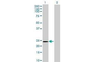 Lane 1: GPX8 transfected lysate ( 23. (GPX8 293T Cell Transient Overexpression Lysate(Denatured))