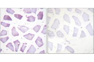 Immunohistochemistry analysis of paraffin-embedded human skeletal muscle, using PEA-15 (Phospho-Ser116) Antibody. (PEA15 抗体  (pSer116))