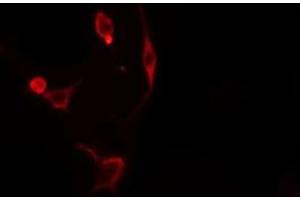 ABIN6276298 staining  Hela cells by IF/ICC. (Caspase 3 抗体  (N-Term))