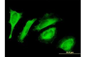 Immunofluorescence of purified MaxPab antibody to C14orf114 on HeLa cell. (EXD2 抗体  (AA 1-496))
