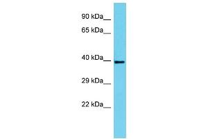 Host: Rabbit Target Name: SERTAD4 Sample Type: HepG2 Whole Cell lysates Antibody Dilution: 1. (SERTAD4 抗体  (C-Term))