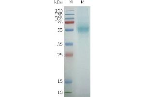 Human PT-Nanodisc, Flag Tag on SDS-PAGE (PTGER4 蛋白)