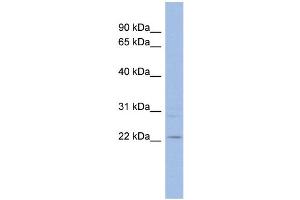 WB Suggested Anti-TAF10 Antibody Titration: 0. (TAF10 抗体  (Middle Region))