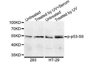 Western blot analysis of extracts of 293 cell lines, using Phospho-TP53-S9 antibody. (p53 抗体  (pSer9))