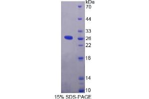 Image no. 1 for Interleukin 1 Receptor Accessory Protein-Like 2 (IL1RAPL2) (AA 161-330) protein (His tag) (ABIN6237225) (IL1RAPL2 Protein (AA 161-330) (His tag))