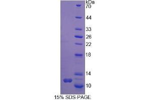 Image no. 1 for Symplekin (SYMPK) (AA 1-75) protein (His tag) (ABIN5665194) (Symplekin Protein (SYMPK) (AA 1-75) (His tag))