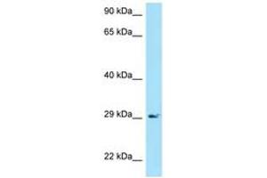 Image no. 1 for anti-B-cell antigen receptor complex-associated protein alpha chain (CD79A) (AA 71-120) antibody (ABIN6748457) (CD79a 抗体  (AA 71-120))