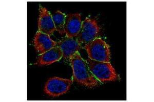 Immunofluorescence (IF) image for anti-Cadherin 1, Type 1, E-Cadherin (Epithelial) (CDH1) antibody (ABIN2854751)