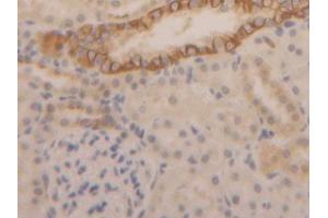 IHC-P analysis of Rat Kidney Tissue, with DAB staining. (Cytokeratin 1 抗体  (AA 350-488))