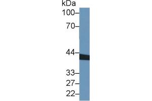 Western Blotting (WB) image for serpin Peptidase Inhibitor, Clade A (Alpha-1 Antiproteinase, Antitrypsin), Member 6 (SERPINA6) ELISA Kit (ABIN6730988)