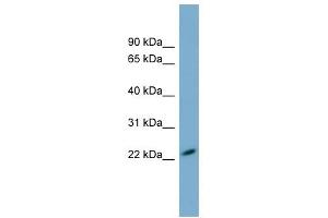 MXRA7 antibody used at 1 ug/ml to detect target protein. (MXRA7 抗体  (N-Term))