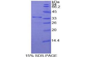 SDS-PAGE analysis of Human Nucleoporin 205 kDa Protein. (NUP205 蛋白)