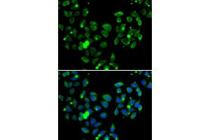 Immunofluorescence analysis of A549 cells using CARD11 antibody. (CARD11 抗体)