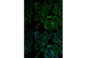 Immunofluorescence analysis of HeLa cell using TNFRSF1A antibody. (TNFRSF1A 抗体  (AA 22-211))