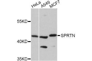 Western blot analysis of extracts of various cell lines, using SPRTN Antibody (ABIN5998942) at 1:3000 dilution. (Spartan 抗体)