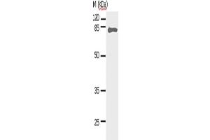 Western Blotting (WB) image for anti-Signal Transducer and Activator of Transcription 5A (STAT5A) antibody (ABIN2427590) (STAT5A 抗体)
