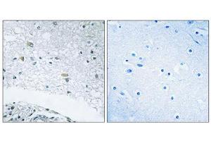 Immunohistochemistry analysis of paraffin-embedded human brain tissue using LAMC3 antibody. (LAMC3 抗体  (C-Term))
