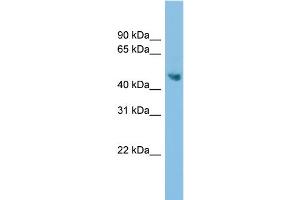 WB Suggested Anti-ADC Antibody Titration: 0. (ADC 抗体  (Middle Region))