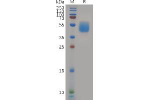 Human Protein, hFc Tag on SDS-PAGE under reducing condition. (GPR87 Protein (AA 1-46) (Fc Tag))