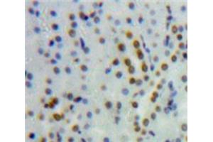 Used in DAB staining on fromalin fixed paraffin-embedded Kidney tissue (HNF4A 抗体  (AA 131-330))
