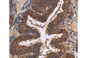 Immunohistochemistry of Human tonsil using LRRC57 Polyclonal Antibody at dilution of 1:40 (LRRC57 抗体)