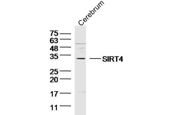 SIRT4 抗体  (AA 51-150)