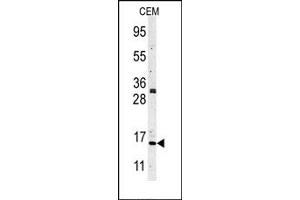 Image no. 1 for anti-Histone 3 (H3) (N-Term) antibody (ABIN356587) (Histone 3 抗体  (N-Term))