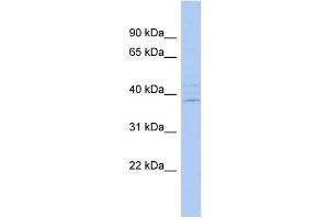 WB Suggested Anti-IQCK Antibody Titration: 0. (IQCK 抗体  (Middle Region))