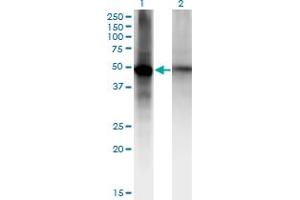 Western Blot analysis of RORB expression in transfected 293T cell line by RORB monoclonal antibody (M09), clone 2D12. (RORB 抗体  (AA 136-224))