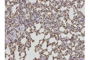 Immunohistochemistry (IHC) image for anti-B-Cell CLL/lymphoma 2 (BCL2) antibody (ABIN1876758) (Bcl-2 抗体)