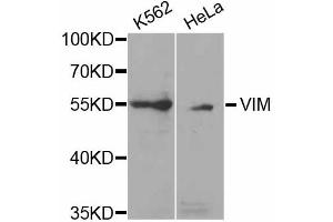 Western blot analysis of extracts of various cell lines, using VIM antibody (ABIN5971408) at 1/1000 dilution. (Vimentin 抗体)