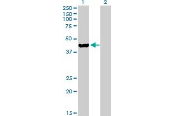 Ethanolamine Kinase 2 抗体  (AA 1-386)